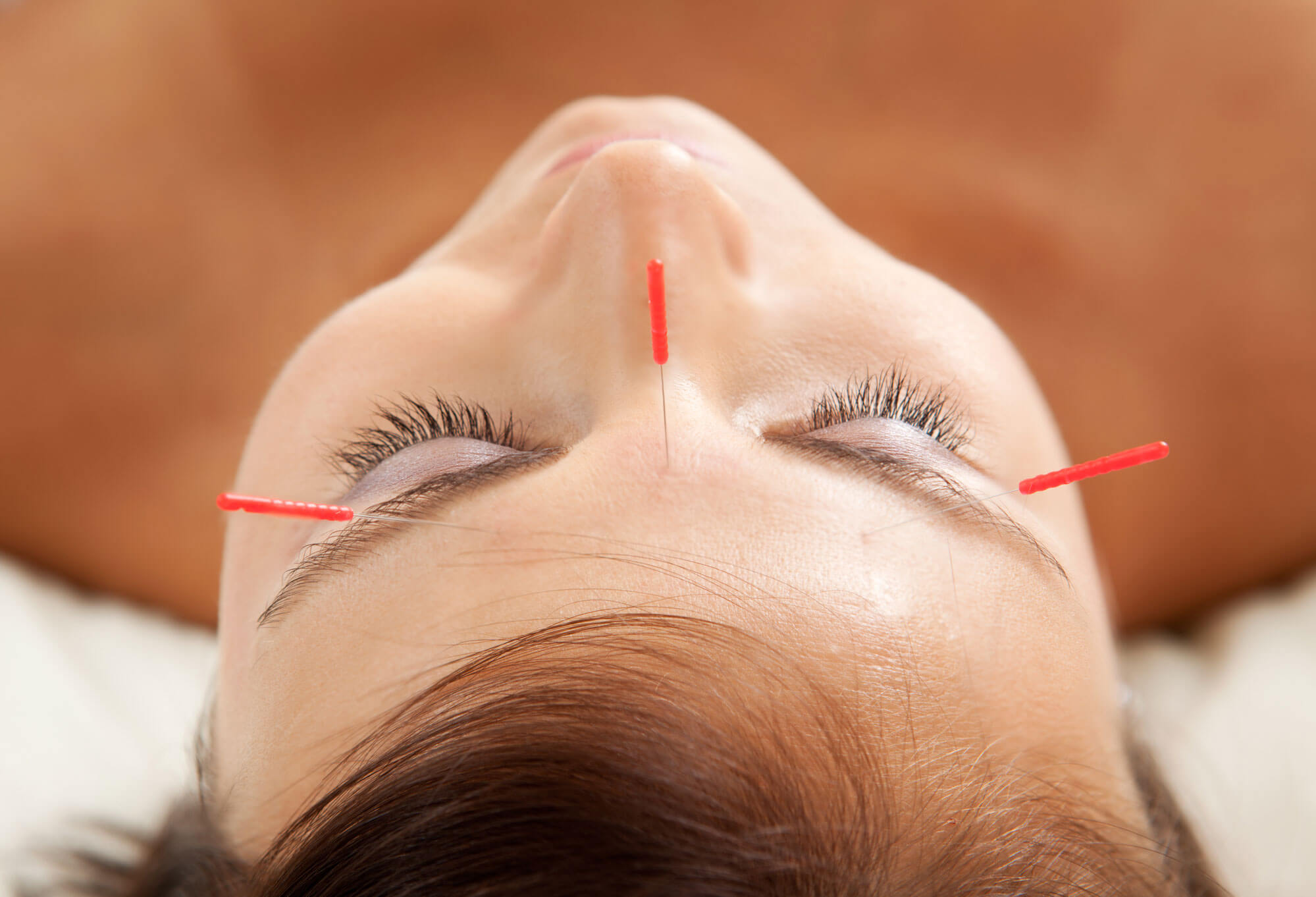 report findings of acupuncture healing